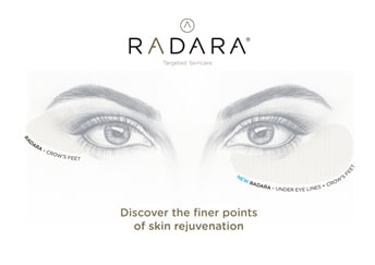 Radara Eye Rejuvenation System Billericay