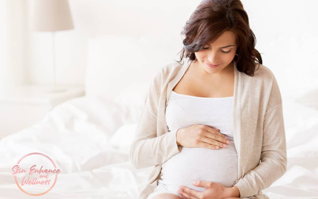 Acne Melasma Chloasma Pregnancy